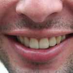 Житель города Орска откусил палец знакомому По этим трем критериям люди оценивают тебя при первой встрече